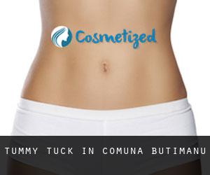 Tummy Tuck in Comuna Butimanu