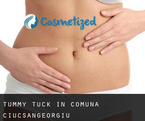 Tummy Tuck in Comuna Ciucsângeorgiu