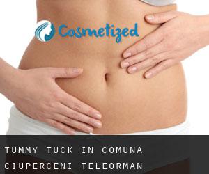 Tummy Tuck in Comuna Ciuperceni (Teleorman)