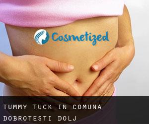 Tummy Tuck in Comuna Dobroteşti (Dolj)