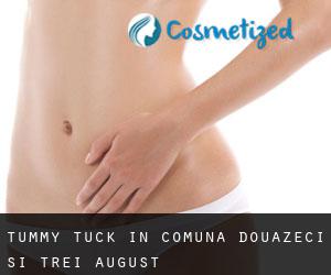 Tummy Tuck in Comuna Douăzeci şi Trei August