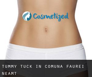 Tummy Tuck in Comuna Fãurei (Neamţ)