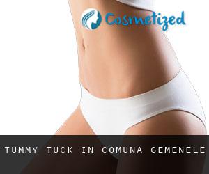 Tummy Tuck in Comuna Gemenele