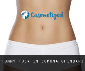 Tummy Tuck in Comuna Ghindari