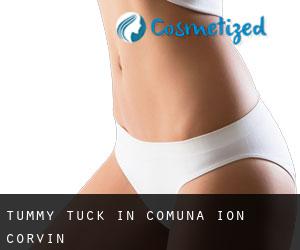 Tummy Tuck in Comuna Ion Corvin