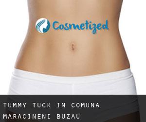 Tummy Tuck in Comuna Mărăcineni (Buzău)