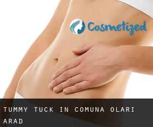 Tummy Tuck in Comuna Olari (Arad)