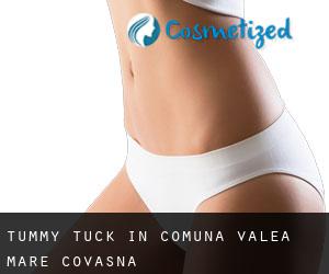 Tummy Tuck in Comuna Valea Mare (Covasna)