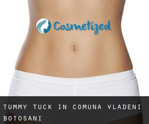 Tummy Tuck in Comuna Vlădeni (Botoşani)