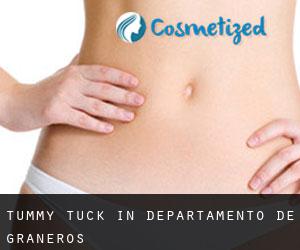 Tummy Tuck in Departamento de Graneros