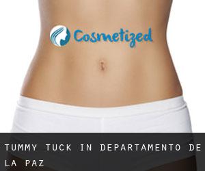 Tummy Tuck in Departamento de La Paz