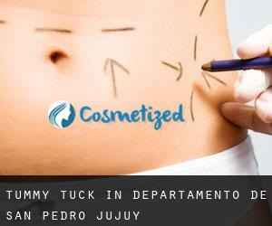 Tummy Tuck in Departamento de San Pedro (Jujuy)