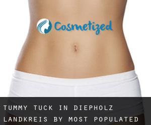 Tummy Tuck in Diepholz Landkreis by most populated area - page 1