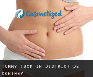 Tummy Tuck in District de Conthey