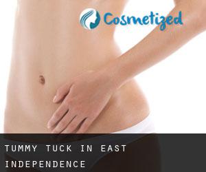 Tummy Tuck in East Independence