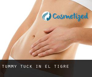 Tummy Tuck in El Tigre