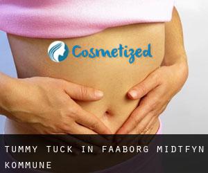 Tummy Tuck in Faaborg-Midtfyn Kommune