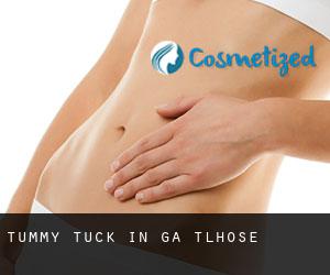 Tummy Tuck in Ga-Tlhose