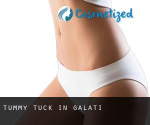 Tummy Tuck in Galaţi