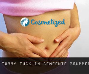 Tummy Tuck in Gemeente Brummen