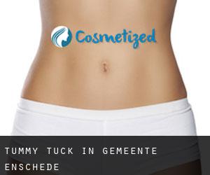 Tummy Tuck in Gemeente Enschede