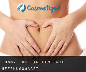 Tummy Tuck in Gemeente Heerhugowaard