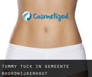 Tummy Tuck in Gemeente Noordwijkerhout