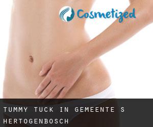 Tummy Tuck in Gemeente 's-Hertogenbosch