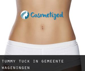 Tummy Tuck in Gemeente Wageningen
