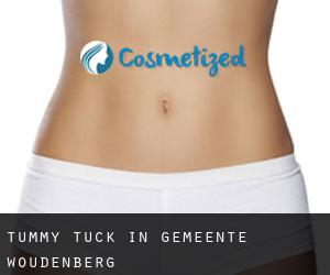 Tummy Tuck in Gemeente Woudenberg