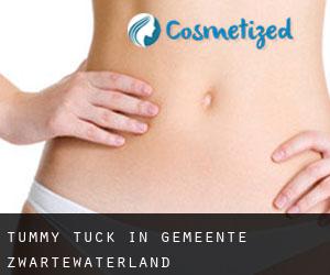 Tummy Tuck in Gemeente Zwartewaterland