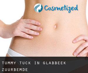 Tummy Tuck in Glabbeek-Zuurbemde
