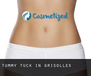 Tummy Tuck in Grisolles