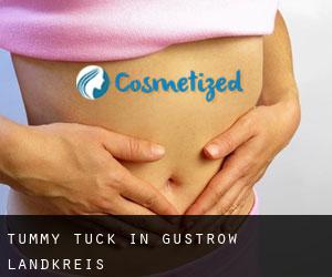 Tummy Tuck in Güstrow Landkreis