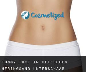 Tummy Tuck in Hellschen-Heringsand-Unterschaar