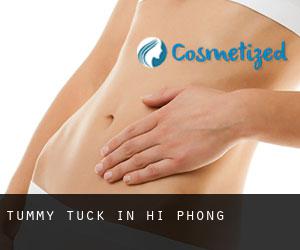 Tummy Tuck in Hải Phòng