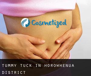 Tummy Tuck in Horowhenua District