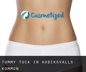 Tummy Tuck in Hudiksvalls Kommun