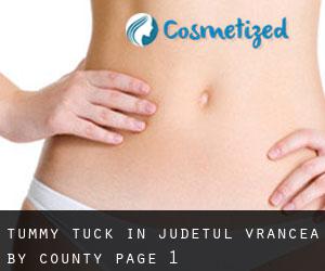 Tummy Tuck in Judeţul Vrancea by County - page 1