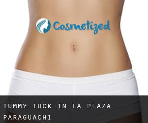 Tummy Tuck in La Plaza Paraguachi