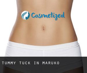 Tummy Tuck in Maruko