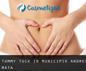 Tummy Tuck in Municipio Andrés Mata