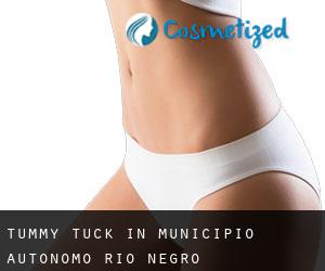Tummy Tuck in Municipio Autónomo Río Negro