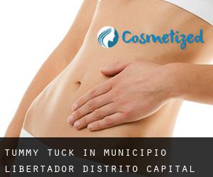 Tummy Tuck in Municipio Libertador (Distrito Capital)