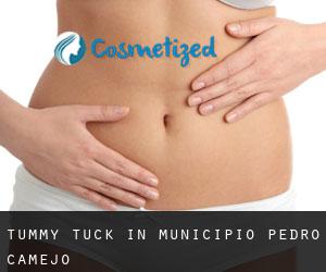 Tummy Tuck in Municipio Pedro Camejo