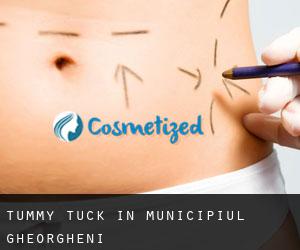 Tummy Tuck in Municipiul Gheorgheni