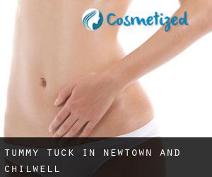 Tummy Tuck in Newtown and Chilwell