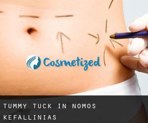 Tummy Tuck in Nomós Kefallinías