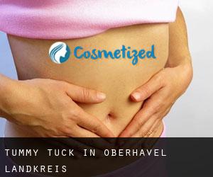 Tummy Tuck in Oberhavel Landkreis