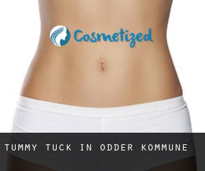 Tummy Tuck in Odder Kommune